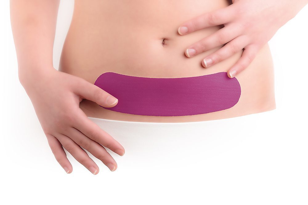 Scarban Pictures Scarban C section purple bewerkt